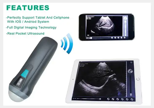 Hot Wireless MINI IOSHome utilizzare attrezzature ad ultrasuoni ultrasuoni B Scanner Uprobe-1