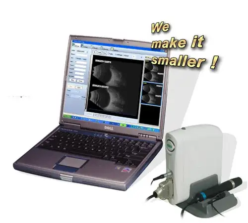 Máquina oftalmológica AB Scan Ecógrafo portátil SW-2100