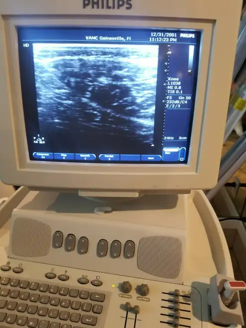 PHILIPS ENVISOR HD M2540A ULTRASOUND MACHINE with L1038 & 15-6L Probes